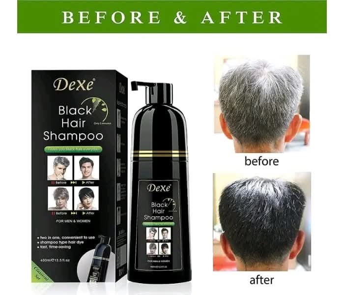 Dexe Black Hair Shampoo 400ml | Instant Hair Color Shampoo For Men & Women | Covers Grey Hair In 5–7 Minutes | Easy & Fast Hair Dye Shampoo - image 2