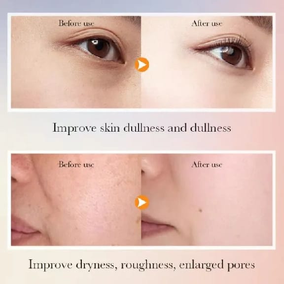 SADOER 5X Vitamin C Brightening Skin Care Gift Box Hyaluronic Acid Face Serum Moisturizing 6 Skin Care Product Set - image 3