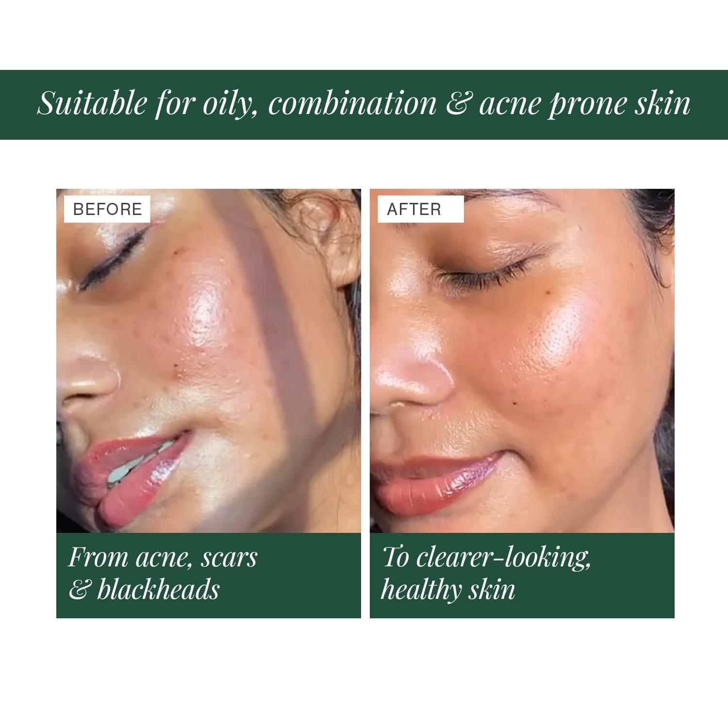 Juicy Chemistry 2% BHA + Zinc PCA Face Serum 10ml - image 4