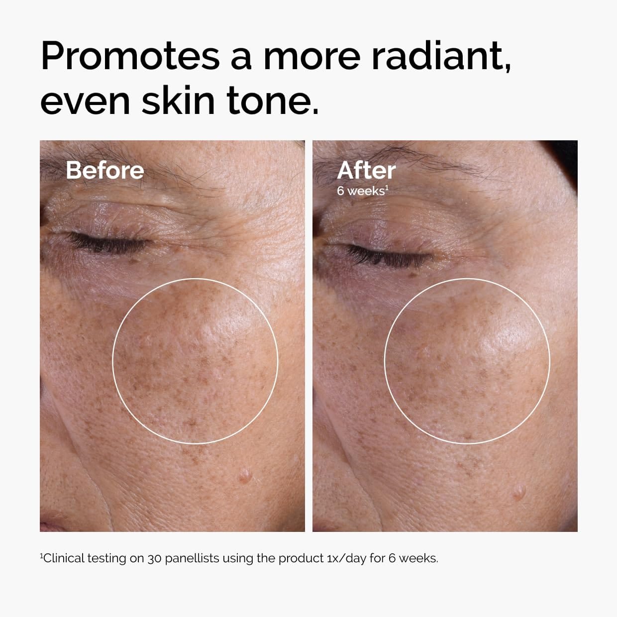 The Ordinary Glycolic Acid 7% Exfoliating Toner, Brightening and Smoothing Daily Toner for More Even-Looking Skin Tone 240ml - image 2