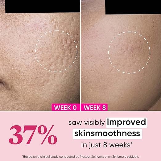 Dot & Key Night Reset Retinol + Ceramide Night Cream | Anti Aging Cream For Women & Men | Reduces Fine Lines & Wrinkles | Oil Free & Non Sticky Moisturizer | For Glowing Youthful Skin | For All Skin Types | 60ml - image 5