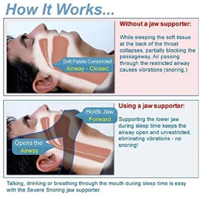 Anti Snore Nose Belt Easily Adjustable Night Sleeping Device (Black + Blue, Diving Cloth, Pack Of 1 Pcs) - image 3
