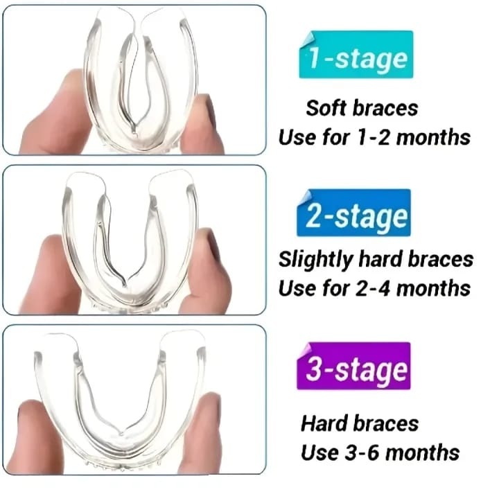 3 In 1 Dental Orthodontic Teeth Corrector Mouth Guard Braces Retainer Straighten Tool - image 3