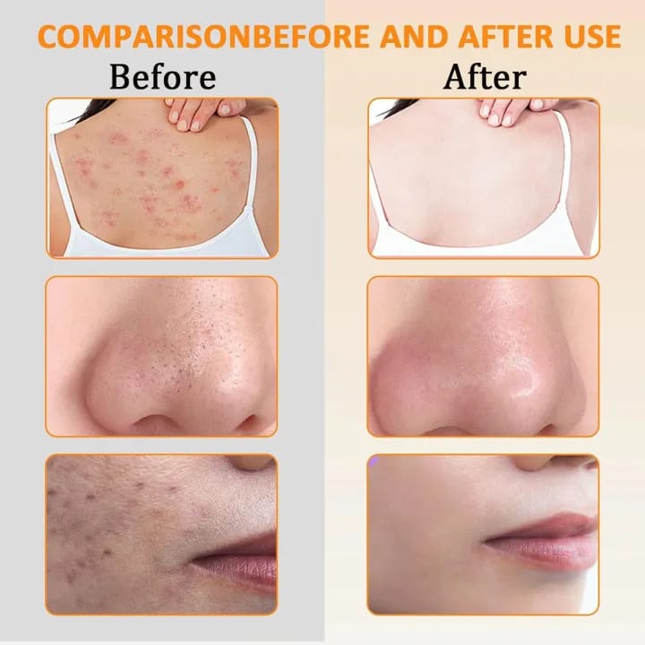 Kojic Acid Soap for Classic, Younger and Even Skin Tone 100g - image 4