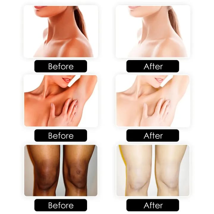 Kojic Acid Soap for Classic, Younger and Even Skin Tone 100g - image 3