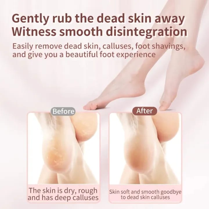 MAANGE 1Pc Rose Gold Professional Callus Remover Pedicure Foot File for Nail Dead Skin Foot Care MAG95242 - image 3